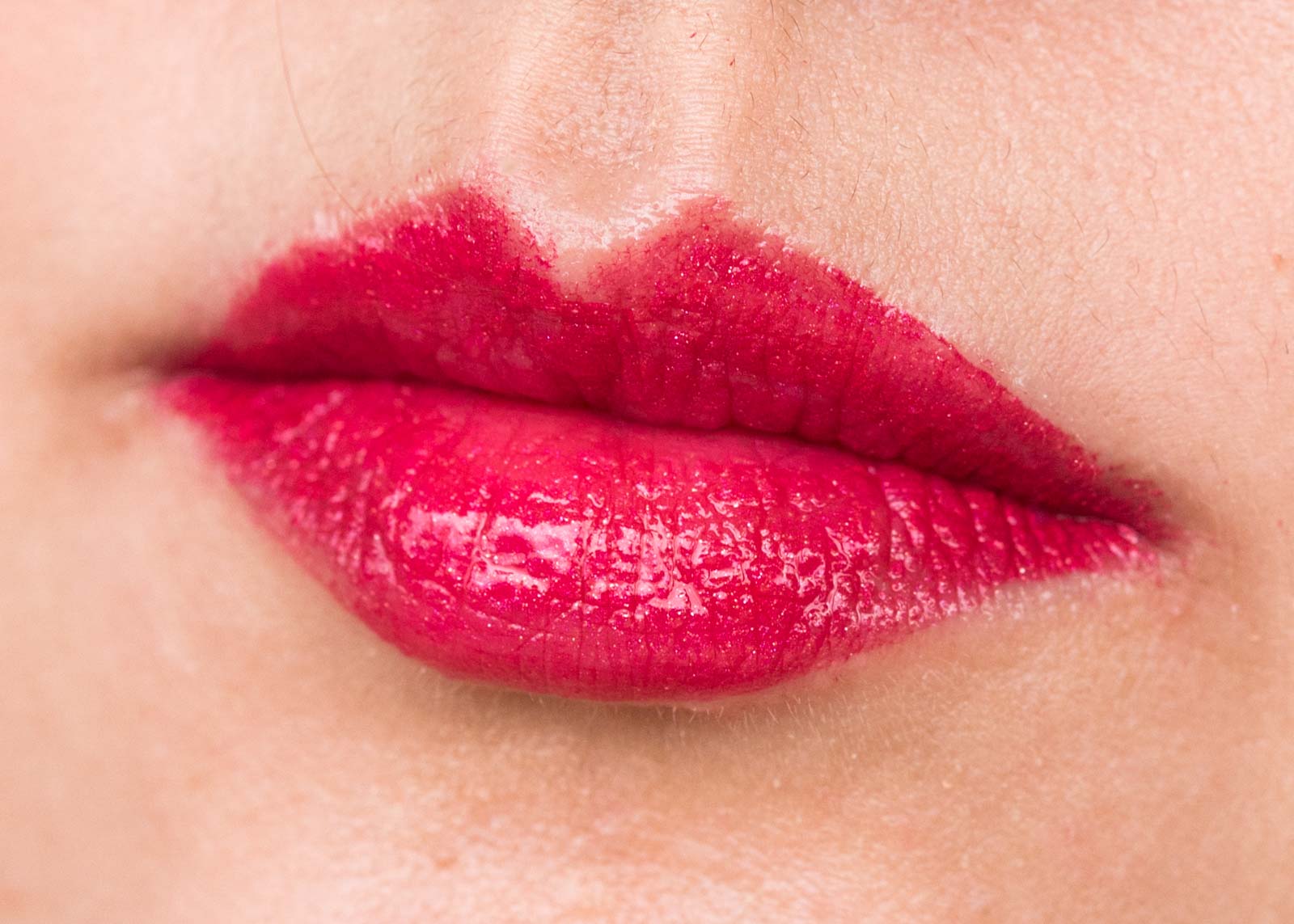 Red Around Lip After Eating Greasy Food Red Around Lip After Eating Greasy Food